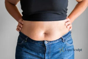 Bidding Farewell to Muffin Tops with Aqualyx Fat Injections 2 Do you wish you could reduce your muffin top Cheadle With Aqualy fat dissolving injections you can!