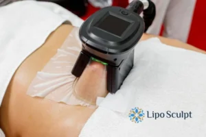 Does Fat Freezing At Home Work? 3 Fat freezing at home from Lipo Sculpt Cheadle
